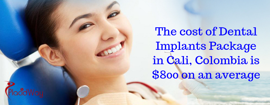 Cost of Dental Implants Package in Cali, Colombia